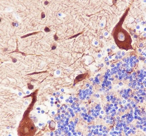 Recombinant beta III Tubulin Monoclonal Antibody - small - 2