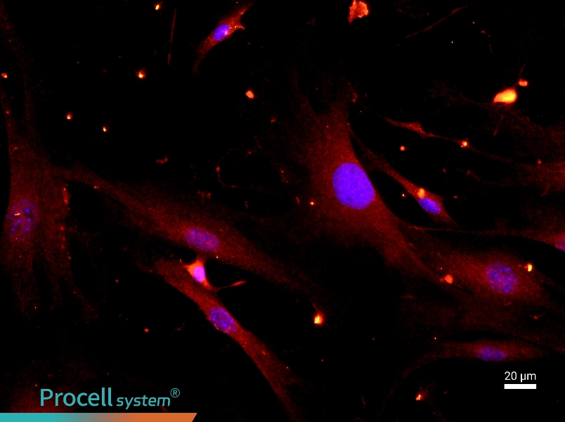 Mouse Synovial Cell Complete Medium - 2