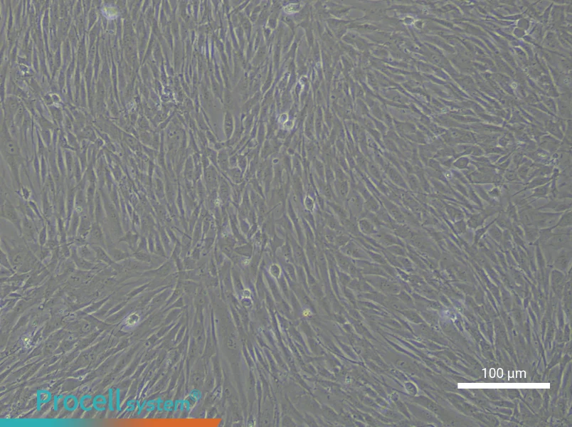 Human Aortic Smooth Muscle Cell Complete MediumHuman Aortic Smooth Muscle Cell Complete Medium - 3