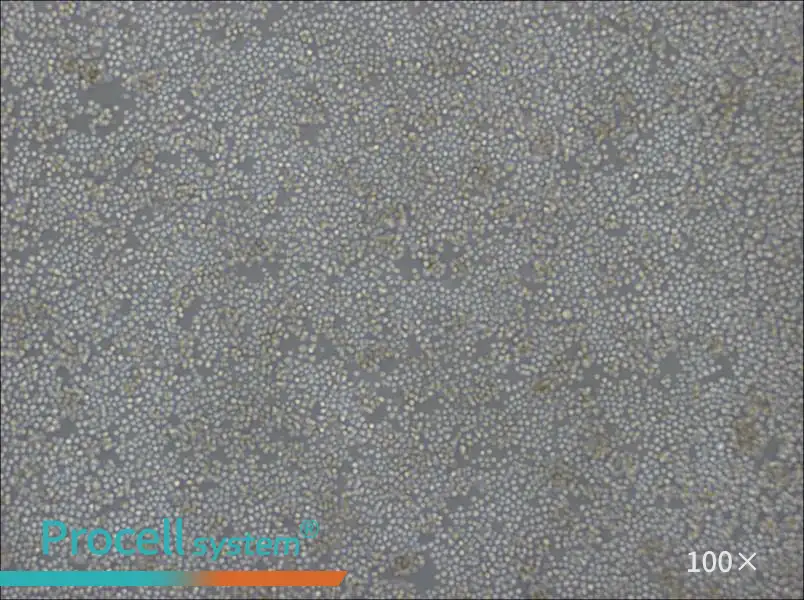 DoHH2 Cell Complete MediumDoHH2 Cell Complete Medium - 3