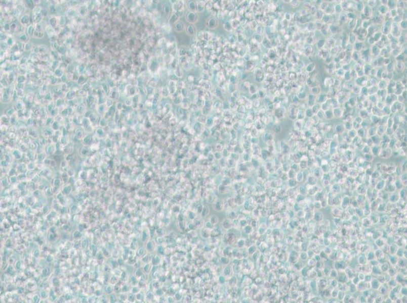 CCRF-SB Cell Complete Medium - small - 6