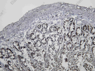 Recombinant UBF-1 Monoclonal Antibody - 2