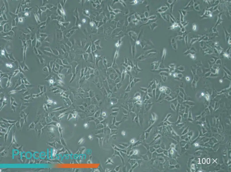 SK-OV-3 Cell Complete Medium - 2