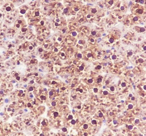 Recombinant ADK Monoclonal Antibody - small - 5