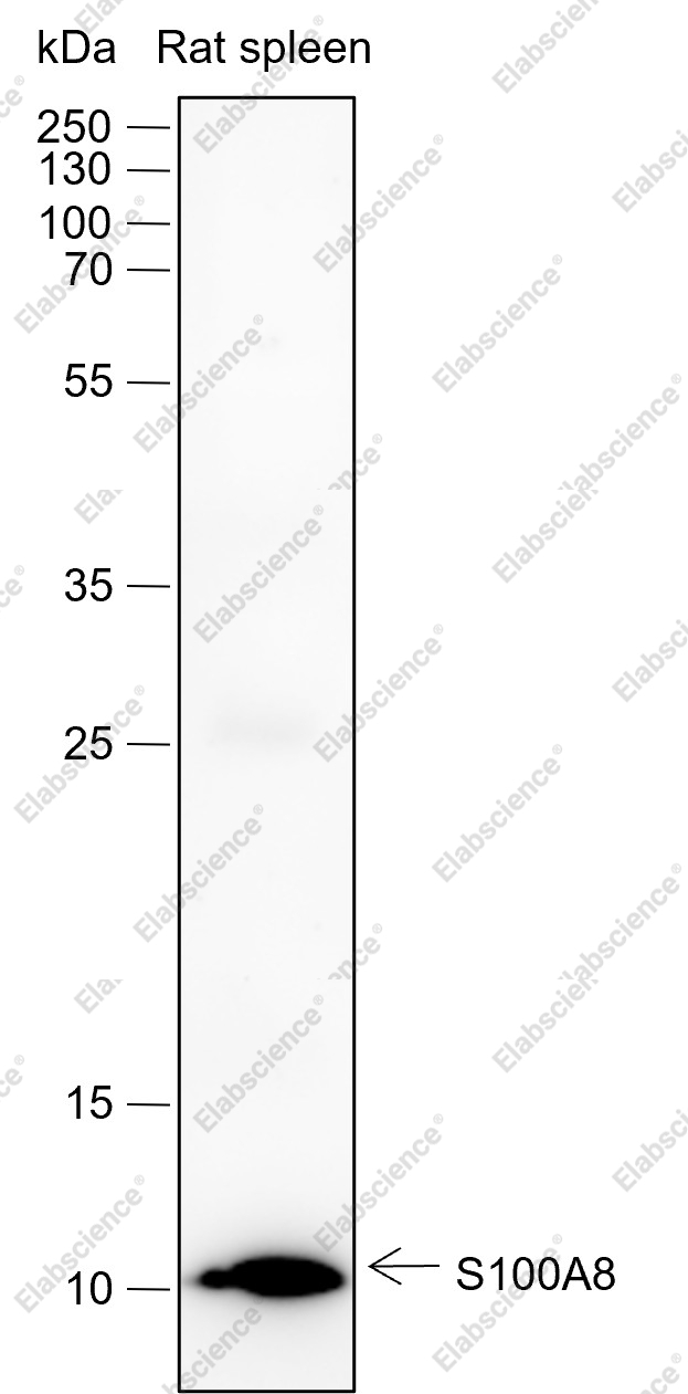 Recombinant S100A8 Monoclonal Antibody - 1