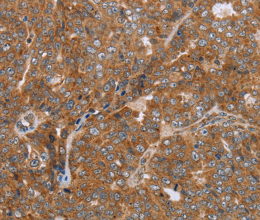 NDUFS2 Polyclonal Antibody - 2
