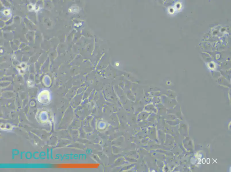 AMC-HN-8 Cell Complete Medium - 5