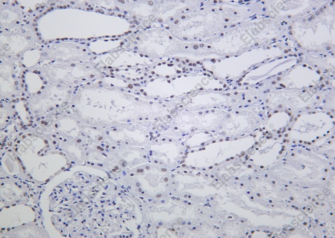 Recombinant ARID1A Monoclonal Antibody - 1