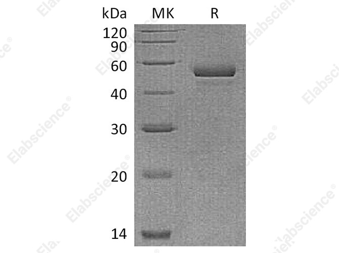 Recombinant Human NPTX1 Protein (His Tag) - 1