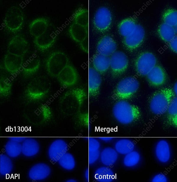 Recombinant IFNAR1 Monoclonal Antibody - 2