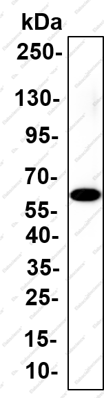 Recombinant RARα Monoclonal Antibody - 1