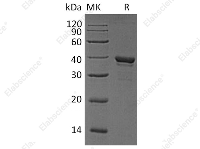 Recombinant Human Arginase-1/ARG1 Protein (His Tag) - 1