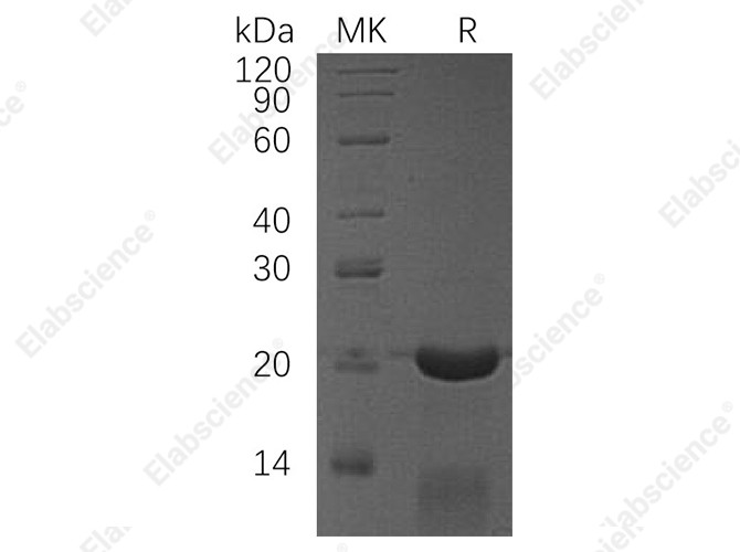 Recombinant Human CRADD/RAIDD Protein - 1