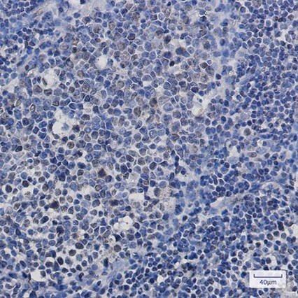 Recombinant TAF15 Monoclonal Antibody - 4