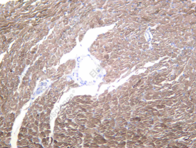 Recombinant NGF Monoclonal Antibody - 2