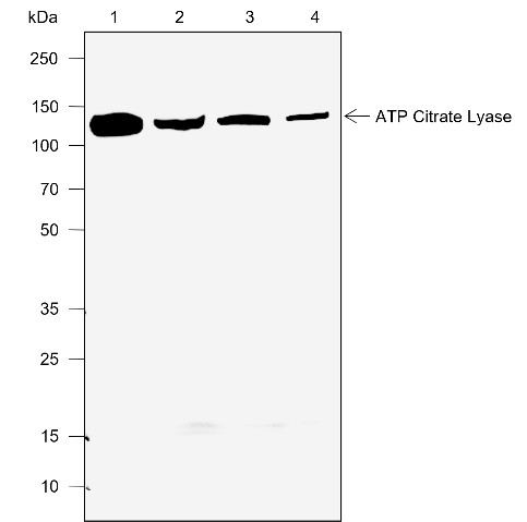 Recombinant ATP Citrate Lyase Monoclonal Antibody-searchlist-1