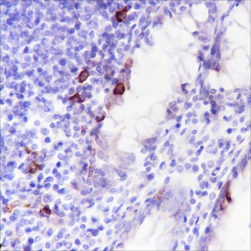 Recombinant Phospho-S6 Ribosomal Protein (Ser240, 244) Monoclonal Antibody - small - 3