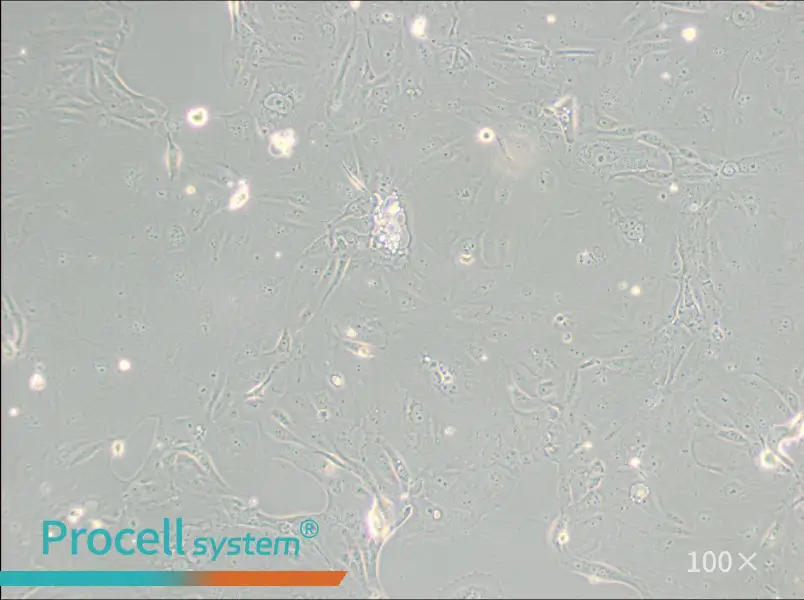 MKN-7 [MKN7; MKN 7] Cell Complete Medium - 3