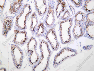Recombinant PBK Monoclonal Antibody - 1