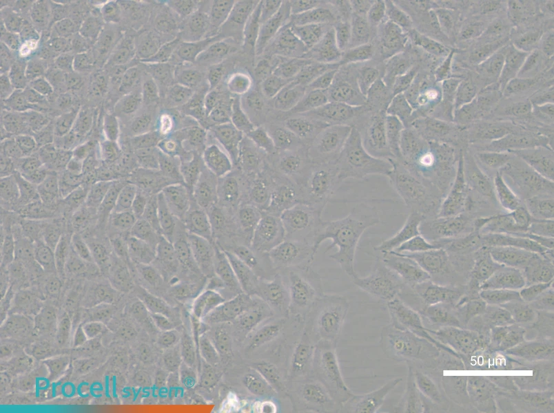 U-2 OS-GFP - 4
