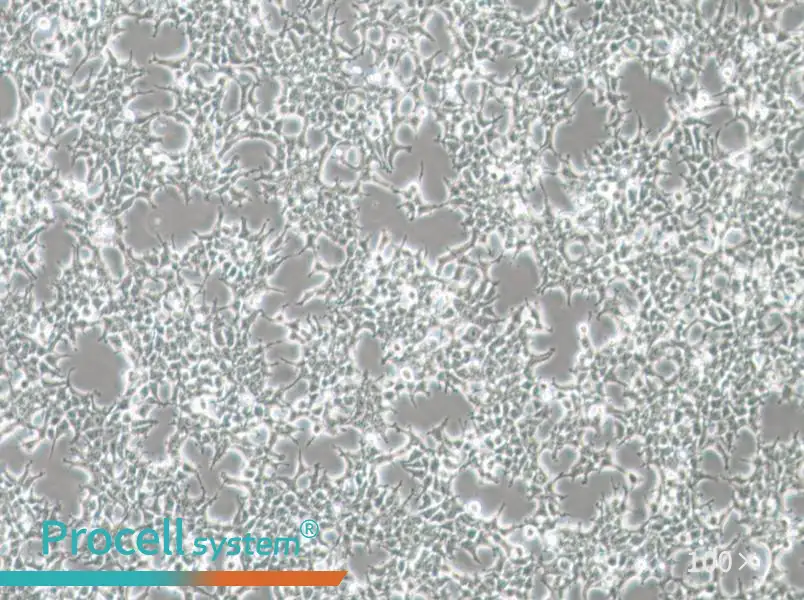 HKb20 Cell Complete Medium - 1