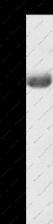 AGPAT6 Polyclonal Antibody - 1