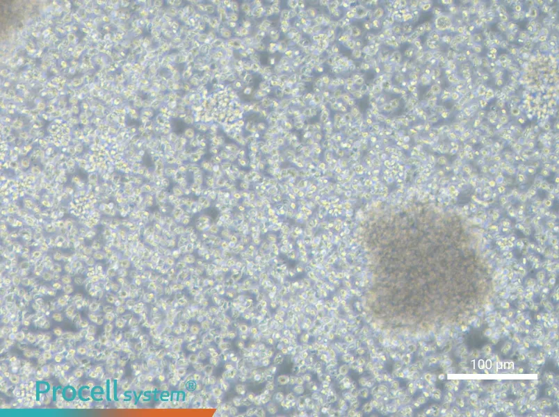 NCI-BL1437NCI-BL1437 - 3