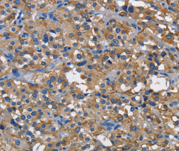 CD160 Polyclonal Antibody - 2