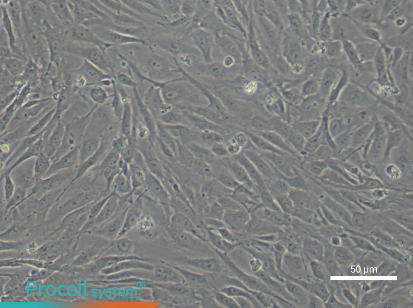 Human Lymphatic Endothelial Cell Complete Medium - small - 5