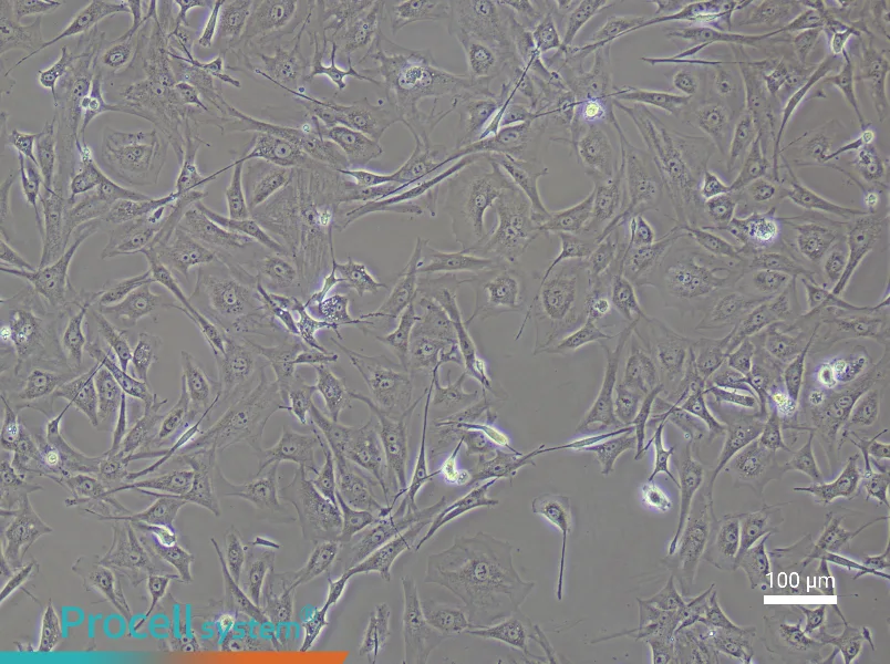 Mouse Prostate Fibroblast Complete Medium - 1