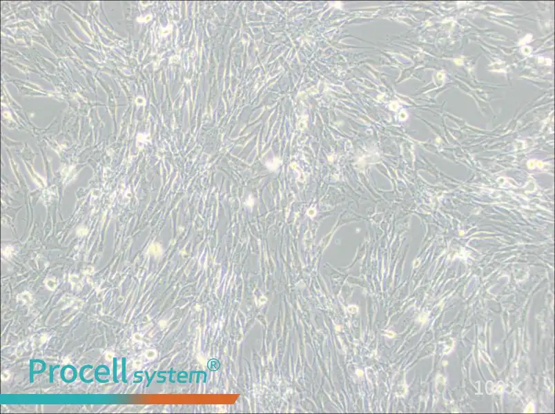 U-118 MG Cell Complete Medium - 1