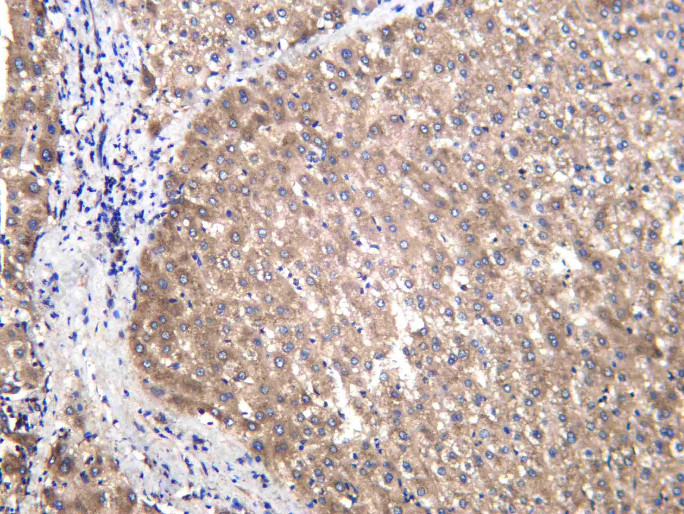 Recombinant EF-1 α1 Monoclonal Antibody - 2