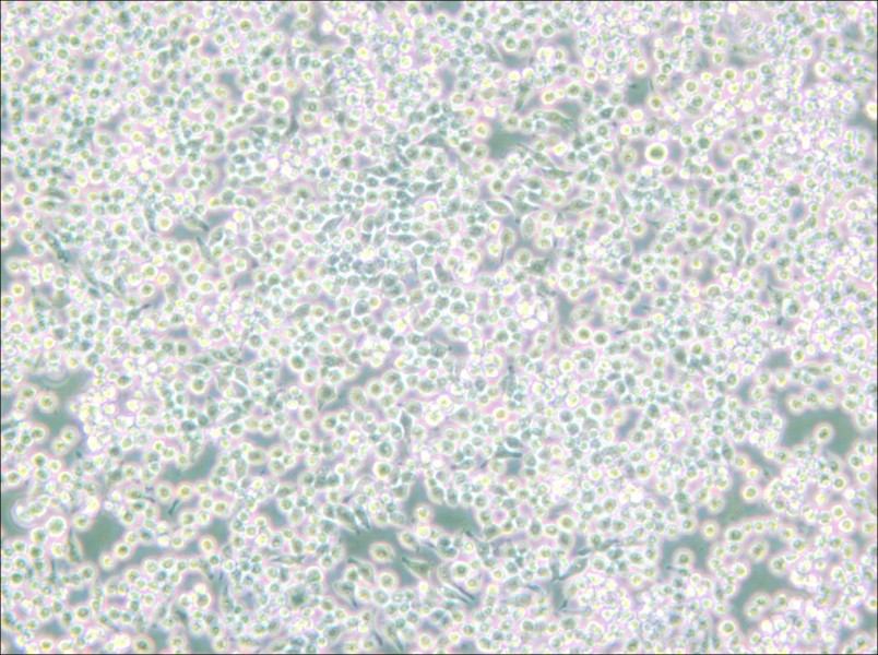 MH-S Cell Complete Medium - 3