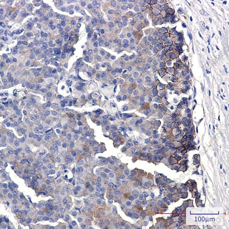 Recombinant EPHB4 Monoclonal Antibody - 2