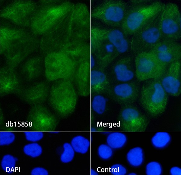 Recombinant Cytokeratin 5/KRT5 Monoclonal Antibody - 3