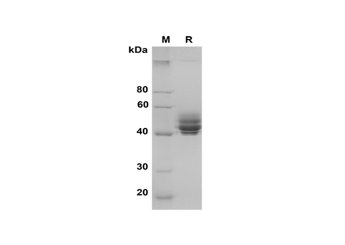 Recombinant Mouse TNF-α Protein(GST Tag)-产品推荐-1