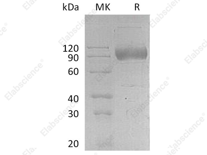 Recombinant Human IL17RA Protein (Fc Tag) - 1