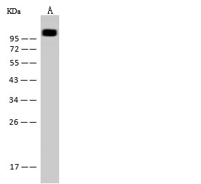 Recombinant CD146/MCAM Monoclonal Antibody-searchlist-1