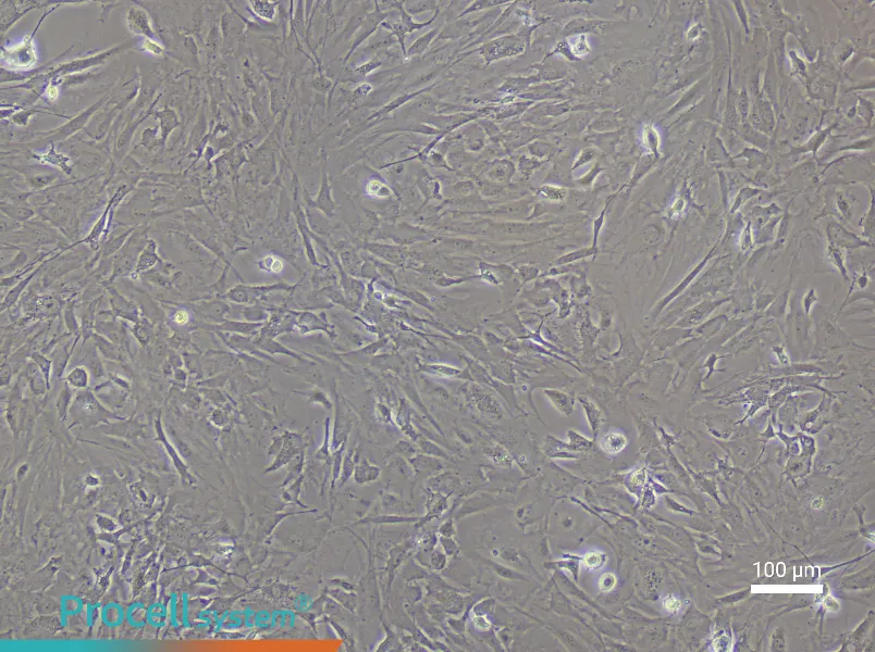 Mouse Brain Fibroblast Complete Medium - 1