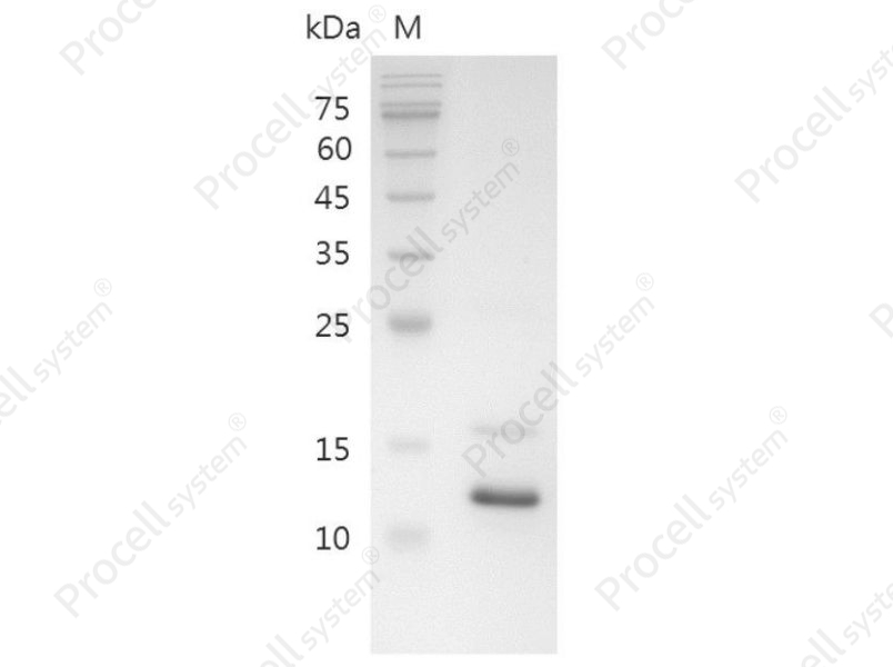 TNF-&alpha;/TNFA/TNFSF2, Swine, Recombinant