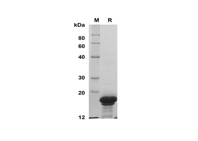 Recombinant Human MCSF Protein(GST Tag)-产品推荐-1