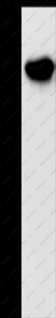 NDRG3 Polyclonal Antibody - 1