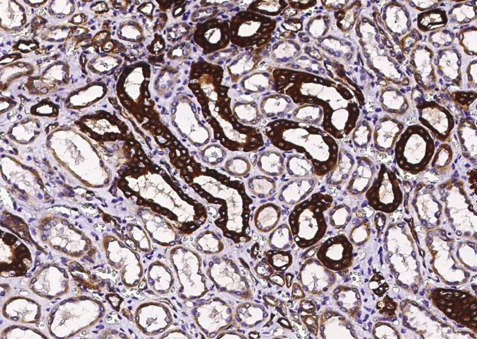 Recombinant TRAIL R4/CD264/TNFRSF10D Monoclonal Antibody - small - 2