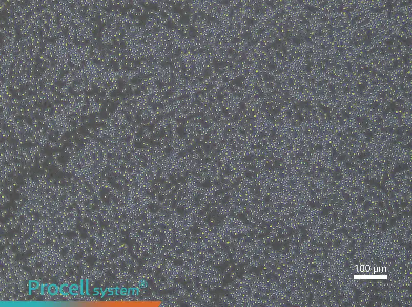 Mouse Splenic Lymphocyte Complete Medium - 2
