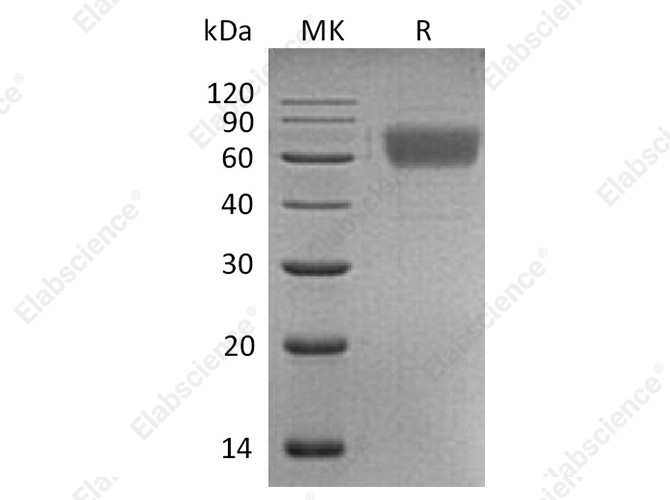 Recombinant Human AMIGO2 Protein (His Tag) - 1