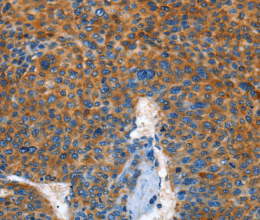 AUP1 Polyclonal Antibody - 2