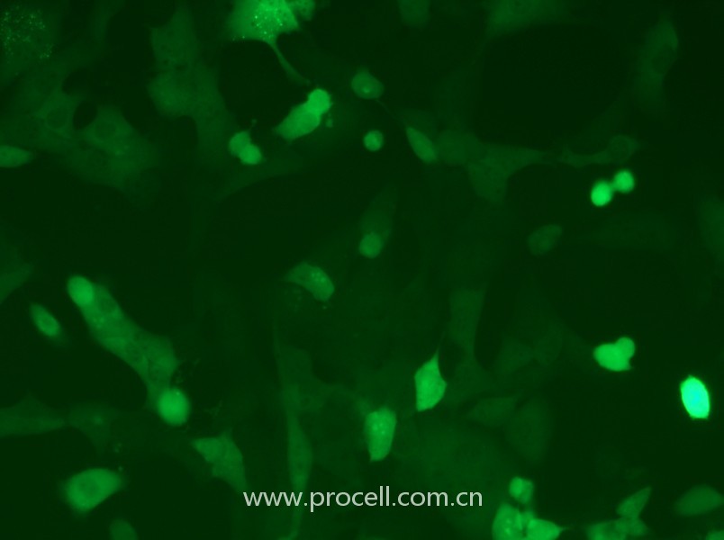 MC38-GFP-1