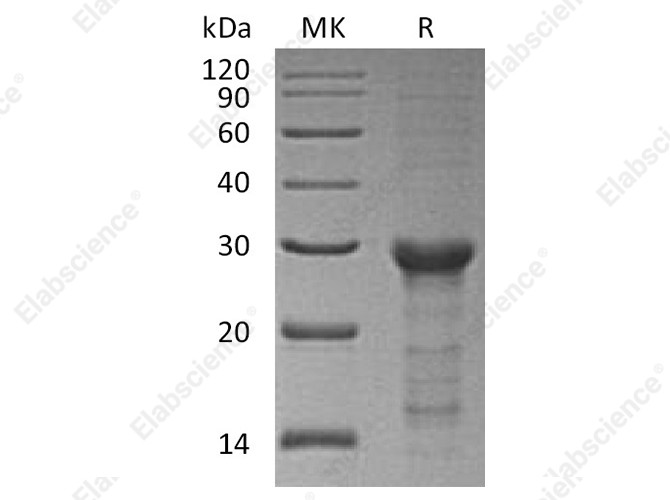Recombinant Human STAT6 Protein (E.coli, His Tag) - 1