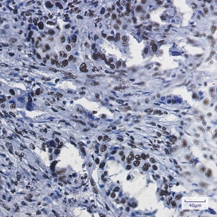 Recombinant RBBP4 Monoclonal Antibody - 2