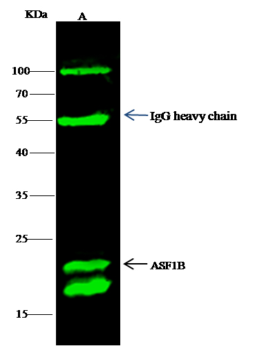 Recombinant ASF1B Monoclonal Antibody-searchlist-1